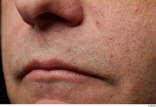  HD Face skin references Saahir Nasir lips mouth nose pores skin texture 0003.jpg
